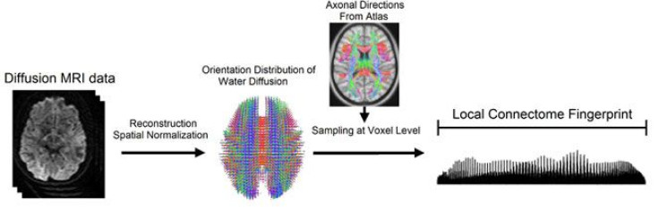 Brain Fingerprint