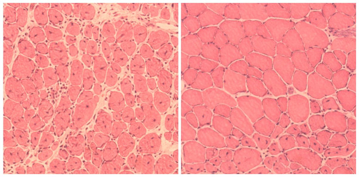 Muscle reversed ageing 