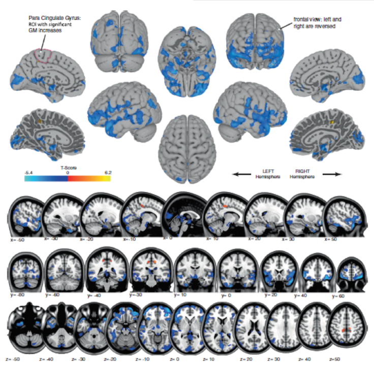 Human Brain in Space