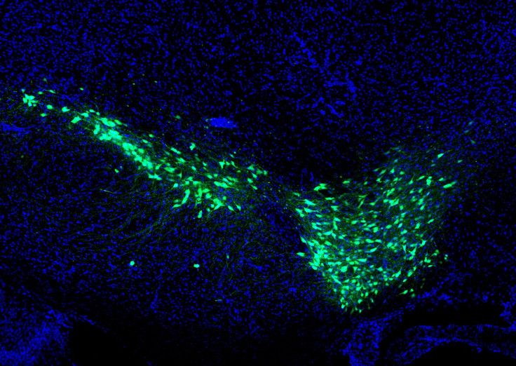 Dopamine2-hr