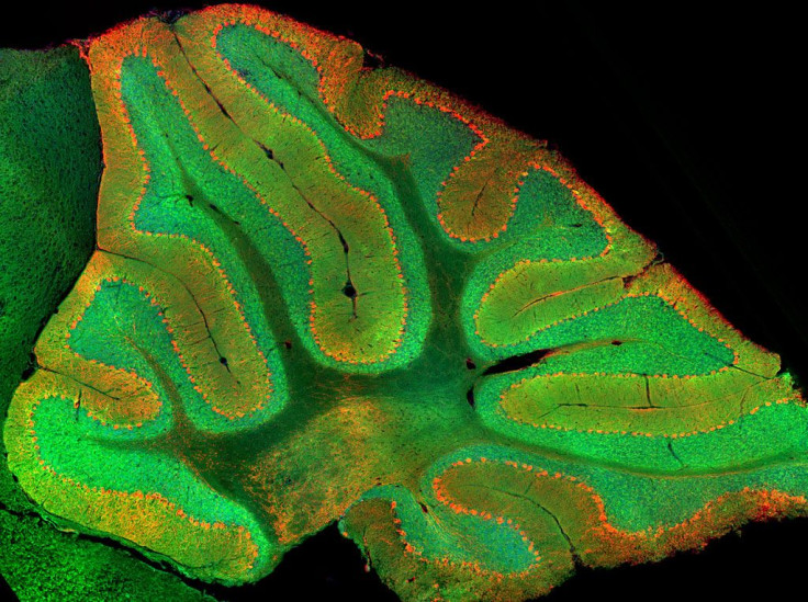 cerebellum