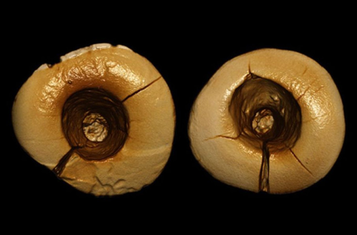 ice-age-dentistry