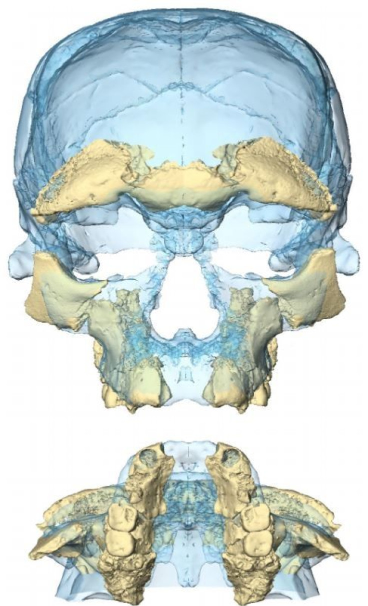 facial-reconstruction