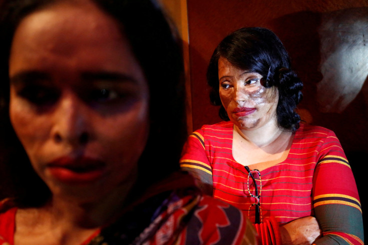 Acid attack survivor