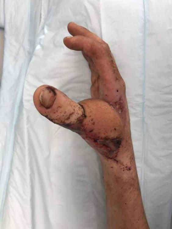 hand