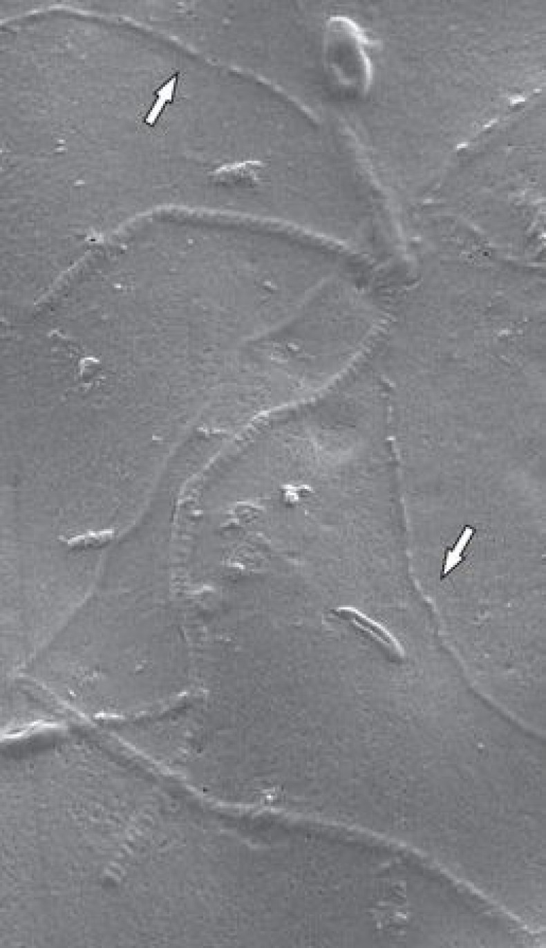 sperm-fossil