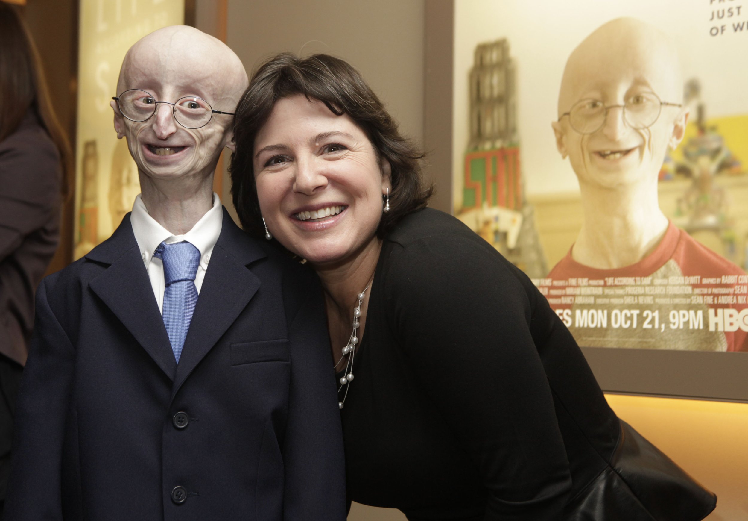 Progeria Facts How Long Can You Live With The Benjamin Button 