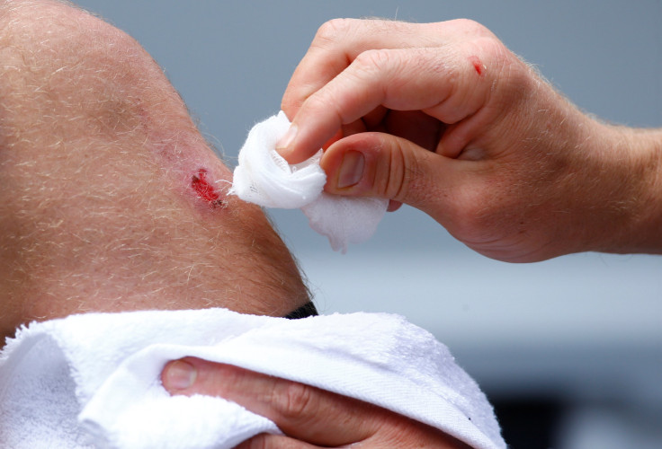 Buruli Ulcer