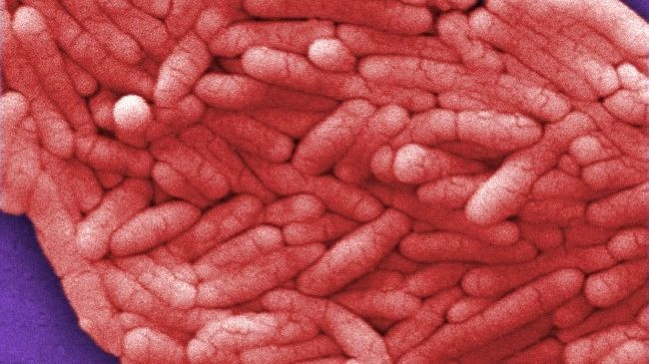 Salmonella Outbreak in the U.S. Kills 1 and Sickens 76