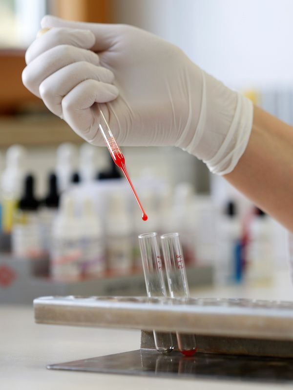 blood test