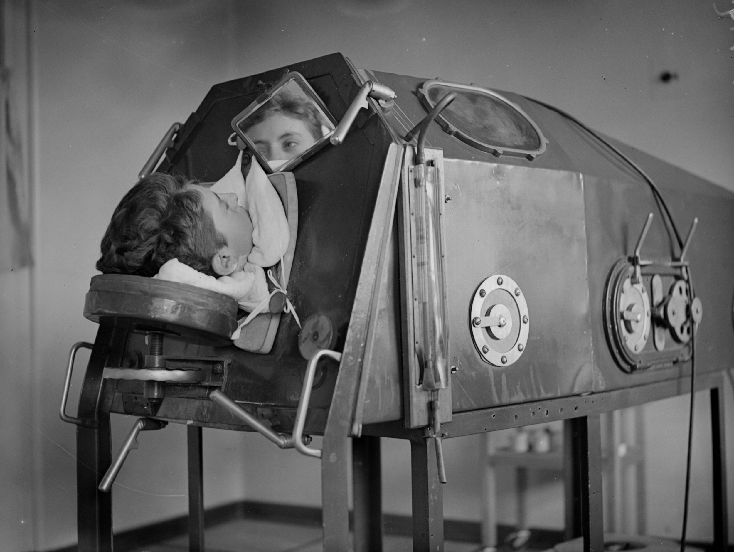 What Is An Iron Lung? Some Polio Survivors Still Use NowObsolete