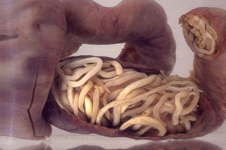 worm-intestine