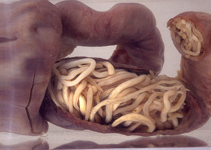 worm-intestine