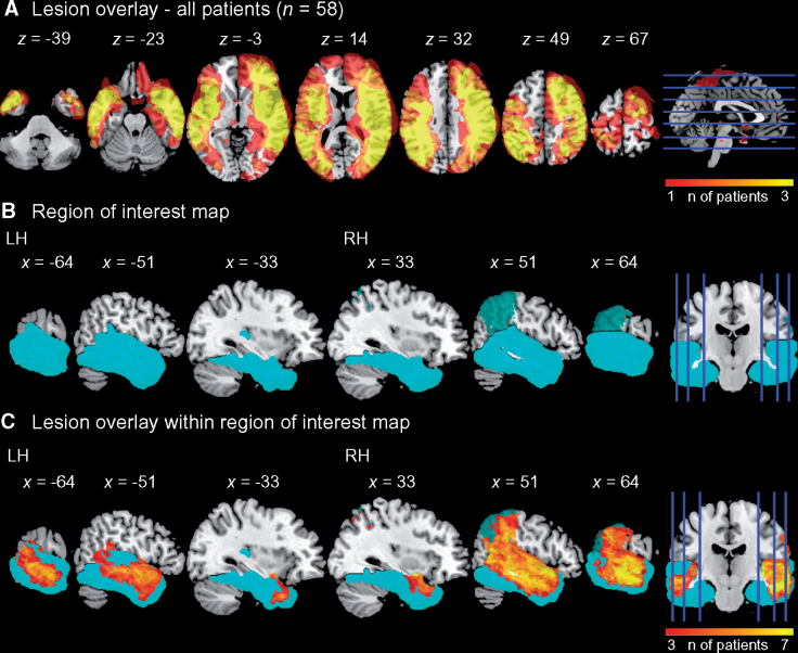 brain scans 