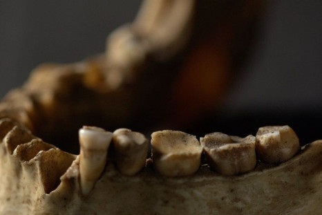 ancient-teeth