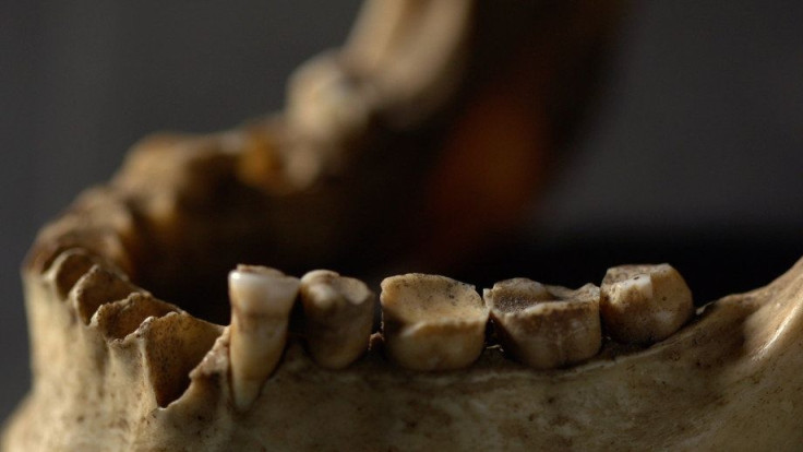 ancient-teeth
