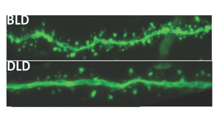 Light Affects Brain Function