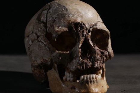 Skull kept on a mantle turns out to be remains from a Tennessee man missing since 2012.