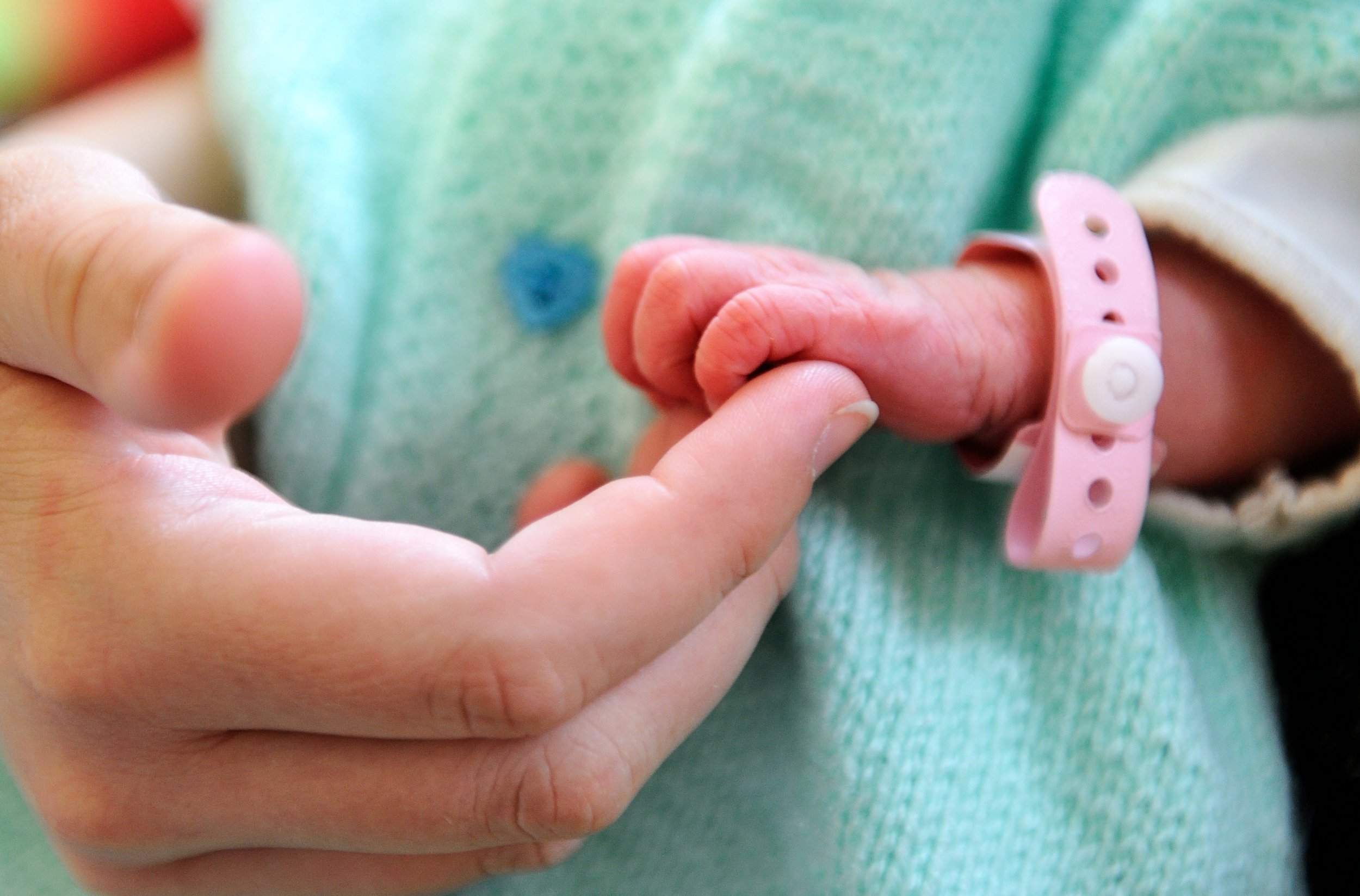 baby-born-with-inverted-legs-abandoned-by-parents-for-having-rare-deformity