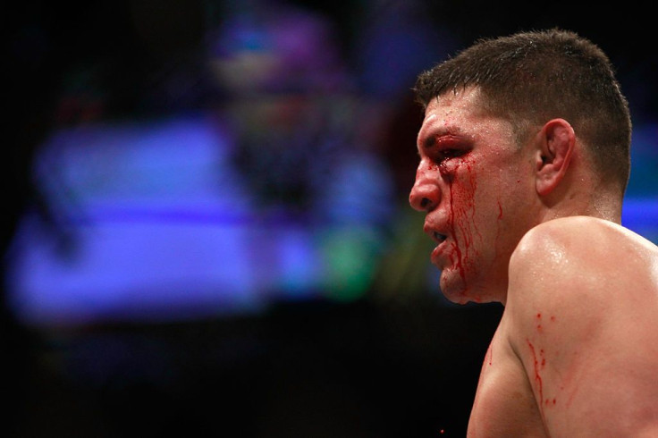 Nick Diaz