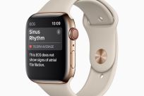 Apple-Watch-Series-4-Sinus-Rhythm-screen-12062018