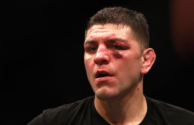 Nick Diaz