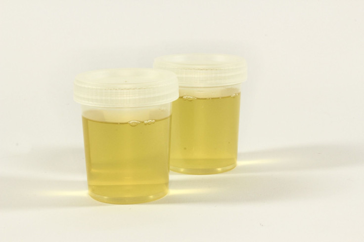 Urine Test