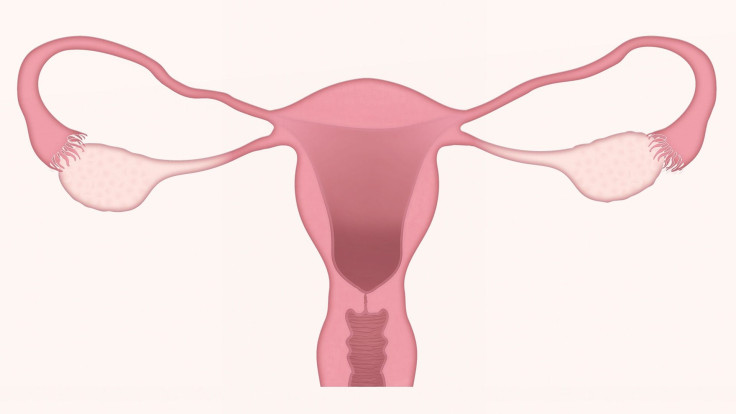 uterus-3777765_1920