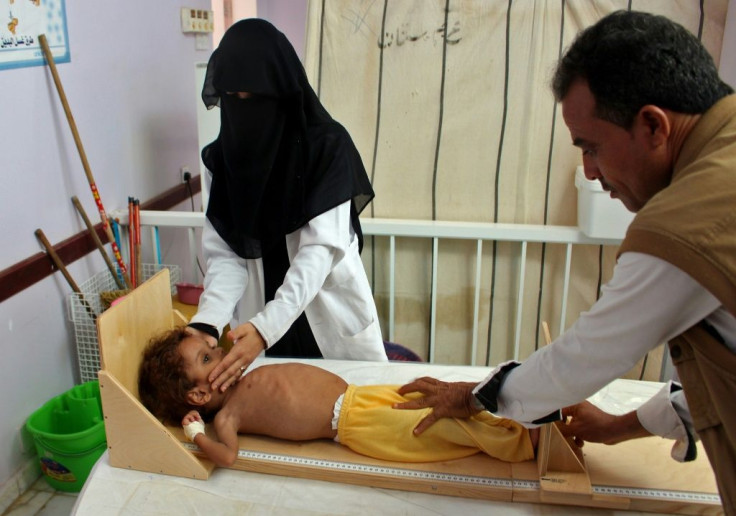A Yemeni child suffering from severe malnutrition is measured at a treatment centre in a hospital in Yemen's northwestern Hajjah province
