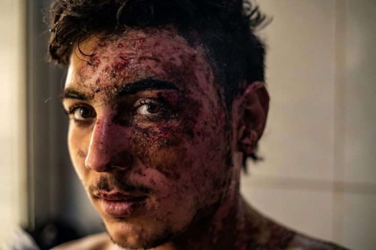 More than 250 fighters of the Kurdish-led Syrian Democratic Forces (SDF) have been killed and many more wounded since Turkey launched its cross-border offensive on October 9, according to the Syrian Observatory for Human Rights