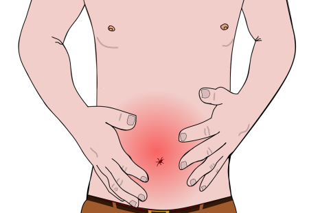 symptoms of bowel cancer