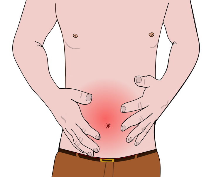 symptoms of bowel cancer
