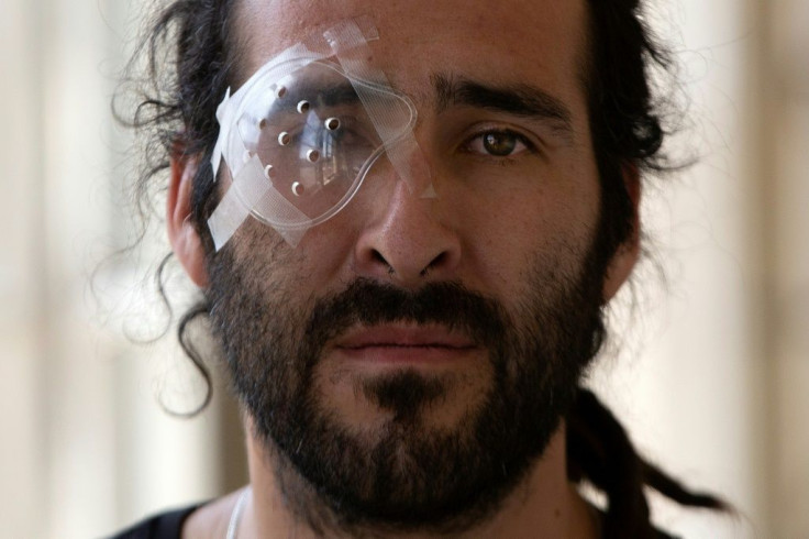 Builder and musician Cesar Callozo was hit in the eye during a demo in central Santiago