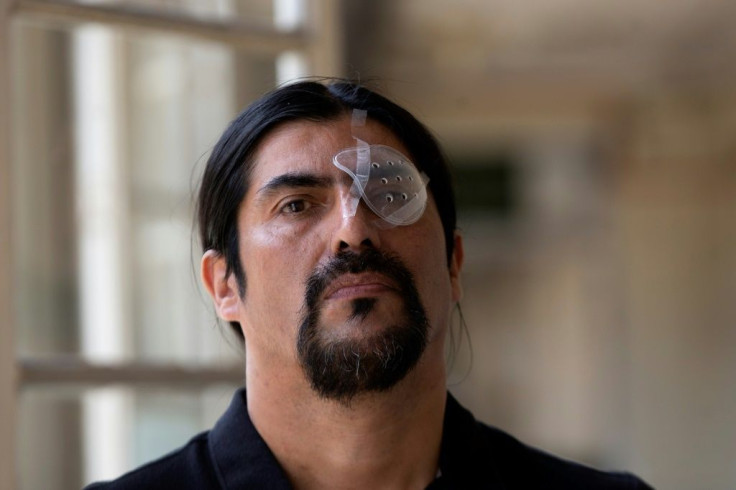 Nelson Iturriaga, 43, came to see doctors to try to save his injured eye, hurt during protests in Chile