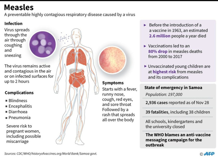 Factfile on measles, a highly contagious disease. An epidemic in Samoa has now claimed 37 lives, according to official data as of Thursday