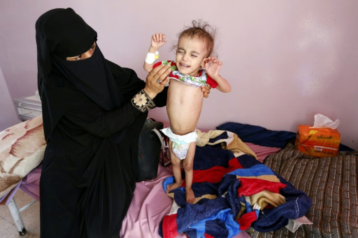 A woman holds a malnourished toddler at Al-Sabeen hospital in the Yemeni capital Sanaa on November 23, 2019: a senior UN official has warned of a renewed threat of famine