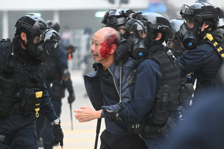 Police detain an injured man at Chater Garden in Hong Kong