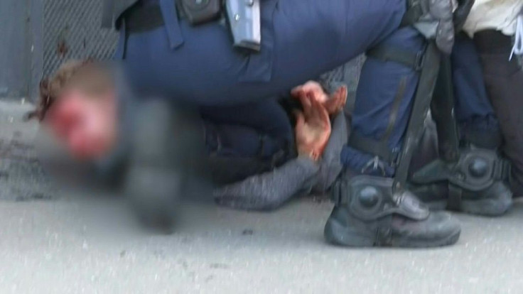 IMAGESImages of a bloodied man being held on the ground by police during a yellow vest protest in Paris on Saturday afternoon. French police arrested several people as thousands of anti-government protesters returned to the streets of the capital.