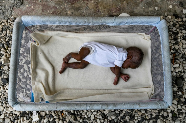 This foster child suffering from malnutrition is one of two hosted by Rose Boncoeur, in Port-au-Prince, Haiti, even though she gets no financial support to feed and clothe them