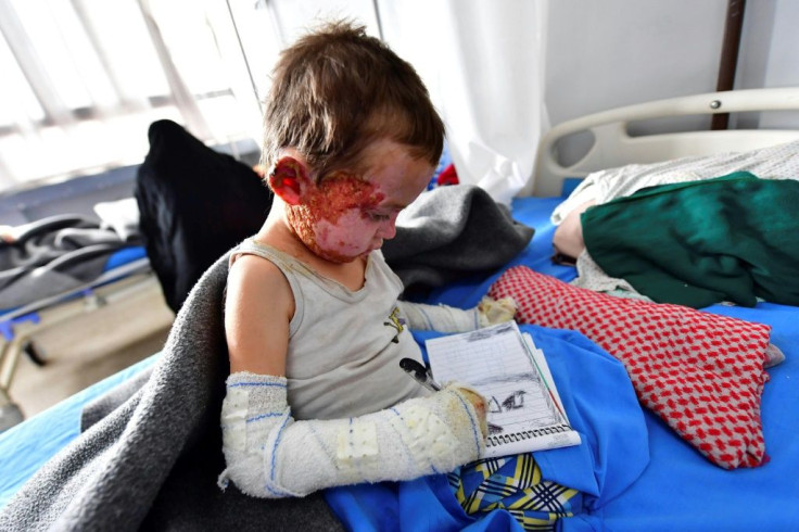 Five-year-old Mariam receives treatment at a hospital in Syria's northeastern Hasakeh province in 2019