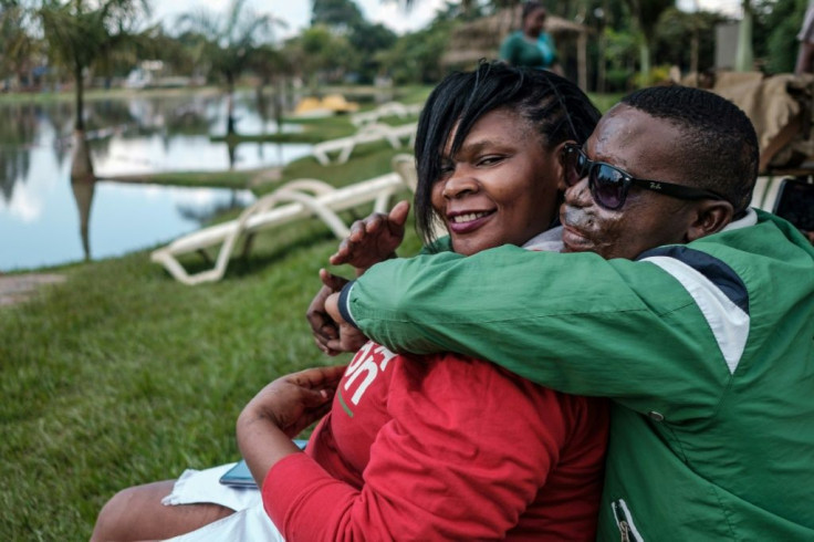 Daniel Kasolo, pictured with his friend and fellow survivor Reenah Ntoreinwe, was attacked with acid by his close friend when he was 18 years old