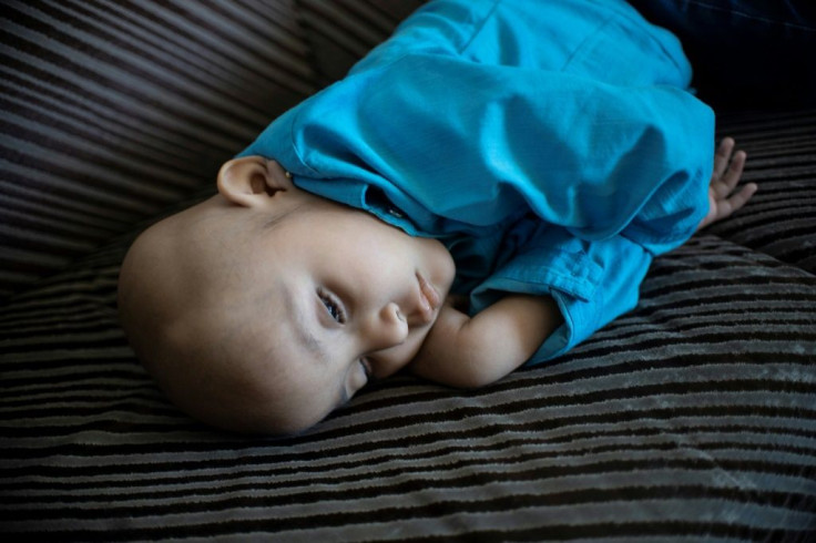 Mexican toddler Cristal Flores, diagnosed with cancer, rests on a couch at a relative's house, in Cuautitlan, Mexico