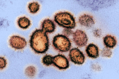 An image of the SARS-CoV-2, the virus that causes COVID-19