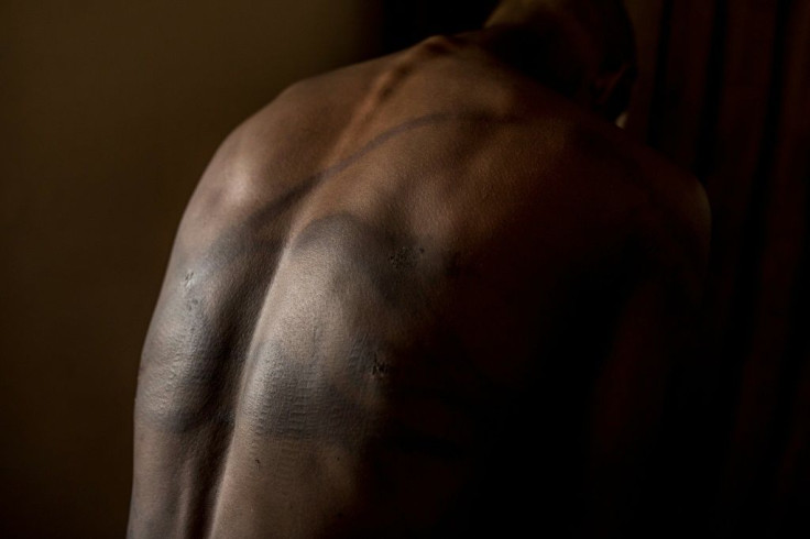 One man treated at the clinic said police had beaten him with cables