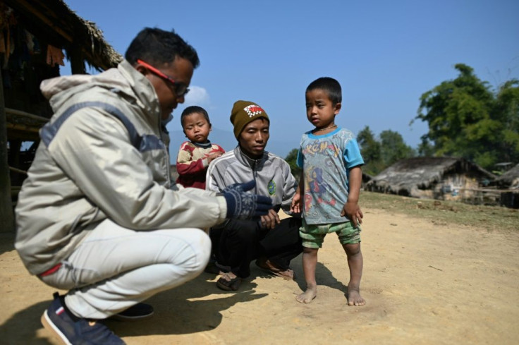 A Medical Action Myanmar doctor helps six-year-old Mg Taing Khite who has been suffering from rickets