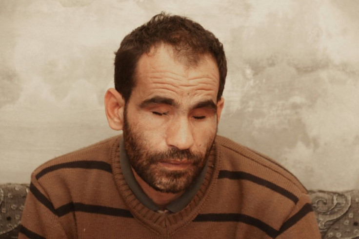 Ali lost his sight when he stepped on a landmine in 2018, having already been wounded multiple times since the start of the Syrian conflict in 2011