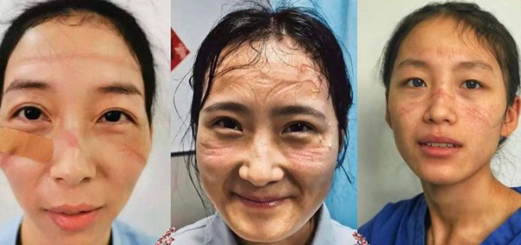 nurses-and-doctors-sore-faces-masks-main-image