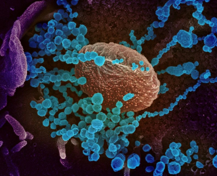 Sanning electron microscope image of the new coronavirus (round blue objects) emerging from the surface of cells cultured in the lab, courtesy of the The National Institutes of Health. The US has recorded more than 14,000 infections