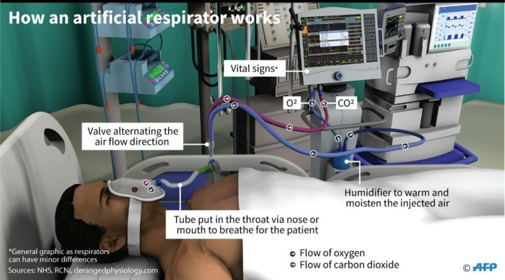 Graphic showing how an artificial respirator works.