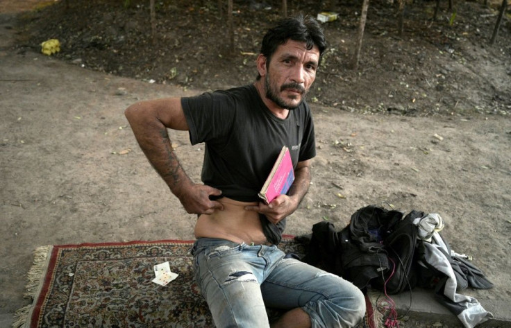 Argentinian Edgardo Villalba, who is homeless, shows bruises he says were caused by police blows he received while begging for food in Buenos Aires